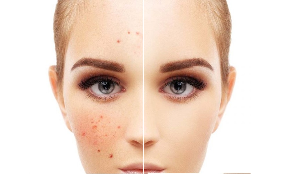 Aarogyapure Pilos, Pigmentation, Hair, Intimate, Infertility and She Care